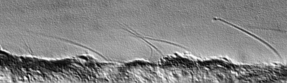 Primary Cilia