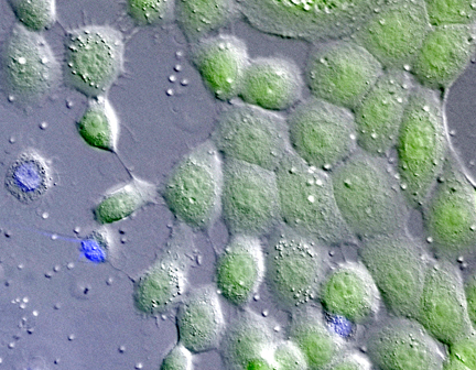 Biomechanics of the cytokeratin network in skin cells